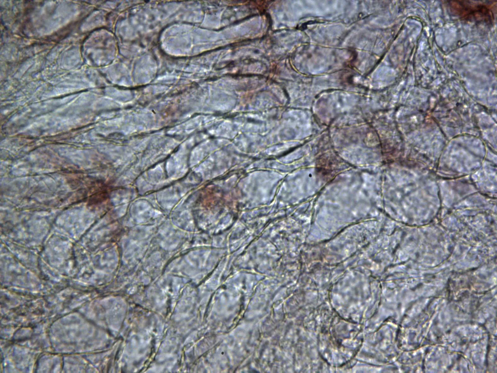 Microscopía de Panaeolus semiovatus - 10 - Cutícula x 400